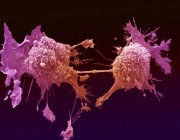 اكتشاف نوع من «السكر» يقضي على الخلايا السرطانية